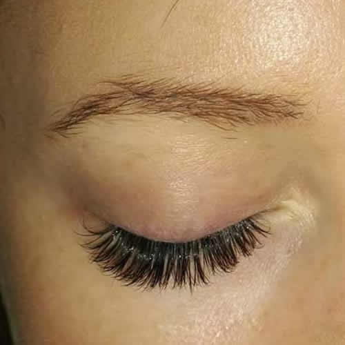 image of customer after some eye treatment